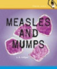 Measles_and_mumps
